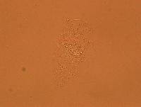 Echiniscoides sigismundi image