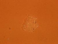 Echiniscoides sigismundi image