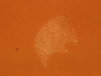 Echiniscoides sigismundi image