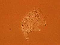 Echiniscoides sigismundi image
