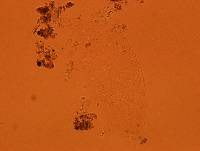 Echiniscoides sigismundi image