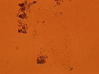 Echiniscoides sigismundi image