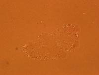 Echiniscoides sigismundi image