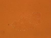 Echiniscoides sigismundi image