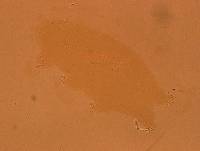 Echiniscoides sigismundi image