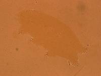 Echiniscoides sigismundi image