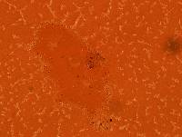 Echiniscoides sigismundi image