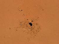 Echiniscoides sigismundi image