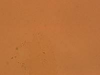 Echiniscoides sigismundi image