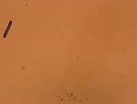 Echiniscoides sigismundi image
