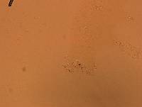 Echiniscoides sigismundi image