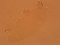 Echiniscoides sigismundi image