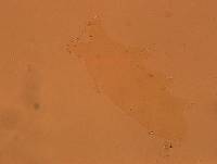 Echiniscoides sigismundi image