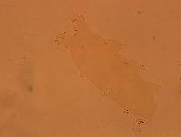 Echiniscoides sigismundi image