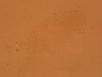 Echiniscoides sigismundi image