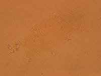 Echiniscoides sigismundi image