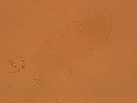 Echiniscoides sigismundi image