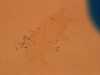 Echiniscoides sigismundi image
