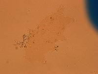 Echiniscoides sigismundi image