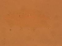 Echiniscoides sigismundi image