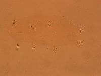 Echiniscoides sigismundi image