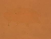 Echiniscoides sigismundi image