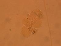 Echiniscoides sigismundi image