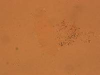 Echiniscoides sigismundi image