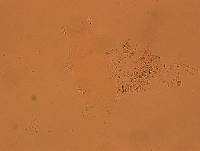 Echiniscoides sigismundi image