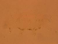 Echiniscoides sigismundi image
