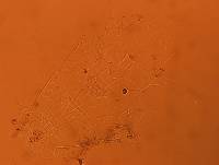 Batillipes gilmartini image