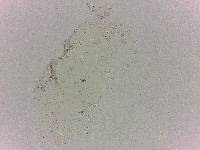 Batillipes minius image