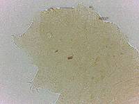 Bryodelphax crossotus image
