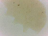 Bryodelphax crossotus image