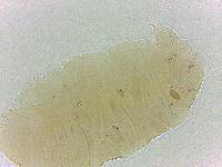 Bryodelphax crossotus image