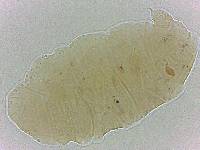 Bryodelphax crossotus image