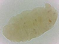 Bryodelphax crossotus image