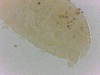 Bryodelphax crossotus image