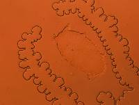 Media resource of Bryodelphax parvulus