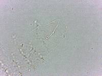 Calohypsibius ornatus image