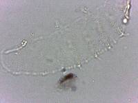 Calohypsibius ornatus image