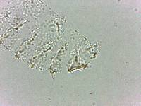 Calohypsibius ornatus image