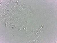 Calohypsibius ornatus image