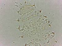 Calohypsibius ornatus image