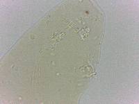 Platicrista angustata image