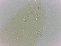 Platicrista angustata image