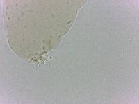 Platicrista angustata image