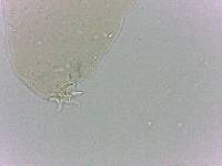 Platicrista angustata image