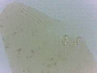Platicrista angustata image