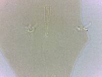 Adropion belgicae image